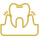 Porcelain Veneers