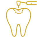 Cosmetic Bonding
